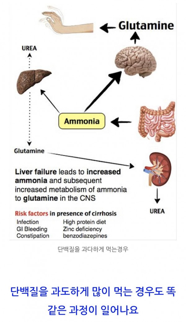 공복운동 할 때 조심해야 되는 이유