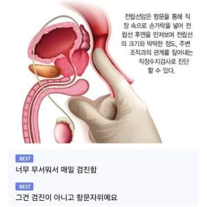 전립선암 진단하는 방법