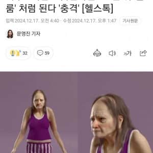 하루 6시간도 못자면 25년뒤 골룸 처럼 된다