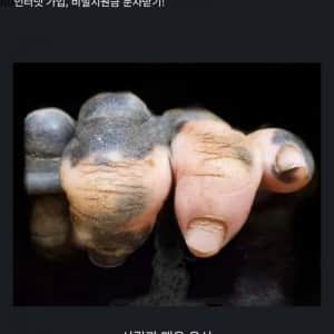 백반증에 걸린 고릴라의 손 