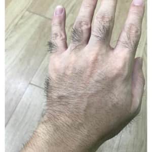 디씨인의 손 인증 대참사