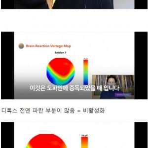 도파민 중독으로 망가진 뇌를 복구시키는 법