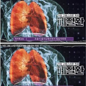 가장 고통스러운 죽음 방식