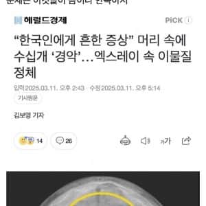 해외에서 논란인 한국형 이쁜이 시술 