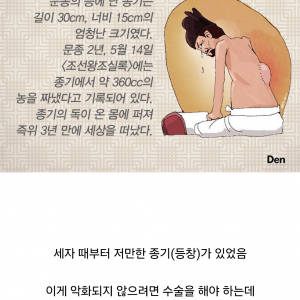 내 등이 다 아픈 조선 5대왕 문종의 등창 크기