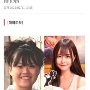 성형에 1억 2900만원 쓴 처자