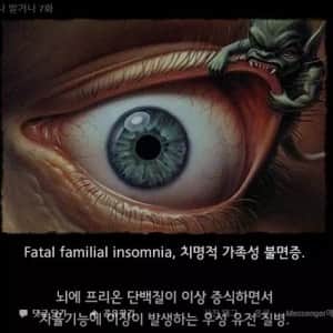 한번 발병하면 죽을때까지 잠을 잘 수 없는 병 
