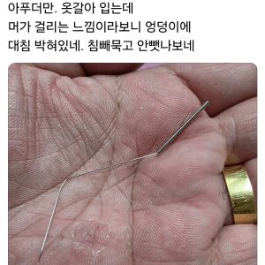 제아봉침에 관통당할뻔한 아재