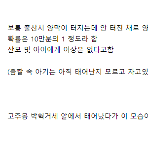 10만분의 1 확률로 양막이 터지지 않은 상태로 태어난 아기