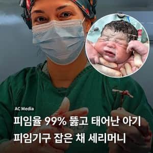 피임율 99% 뚫고 태어난 아기, 피임기구 잡은 채 세리머니 