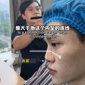 남자 코수술 레전드