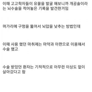 12000년전에 행해진 뇌수술