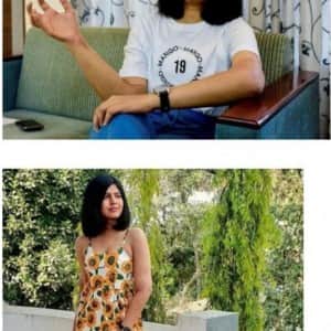 여자 몸에 남자 팔 이식한 후