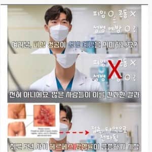 피임기술 발달의 부작용