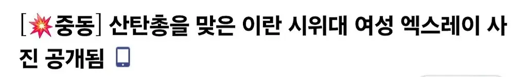 산탄총을 맞은 이란 시위대 여성의 엑스레이 사진 공개