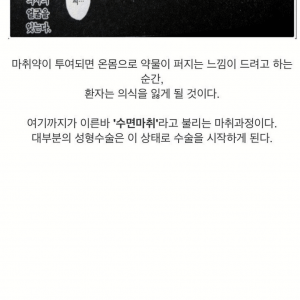 사람들이 모르는 전신마취 과정