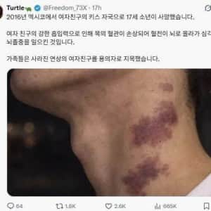목에다 키스하면 안되는 이유