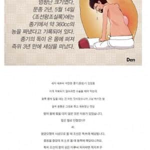 조선 5대왕 문종의 등창 크기