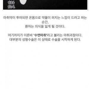 일반인은 잘 모르는 전신마취하는 과정