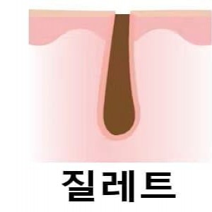 면도날 3황의 면도후 느낌