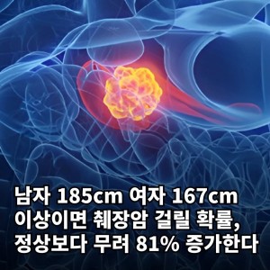 남들보다 췌장암 걸릴 확률 높은 사람 특징
