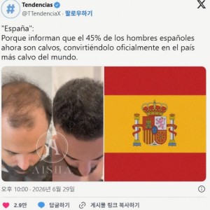 남성 45%가 대머리인 유럽 국가
