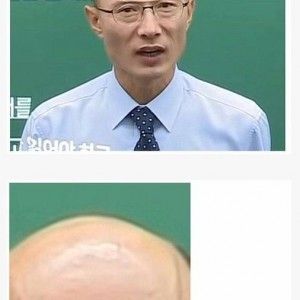 탈모갤 강퇴짤