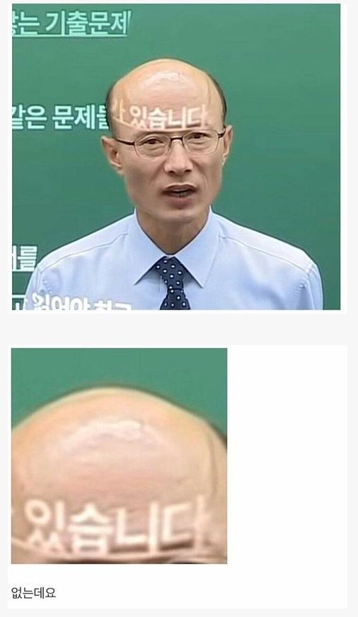 탈모갤 강퇴짤