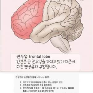전두엽 손상 입었을 때 나타나는 증상
