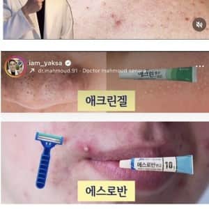 약사가 추천하는 상황별 피부 연고 
