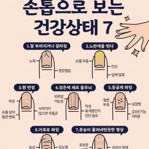 손톱으로 보는 건강 상태 7